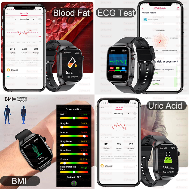 สมาร์ทวอทช์ความแม่นยำสูงรุ่นให - Smartwatch New Watches 2025 บทวิจารณ์และราคา